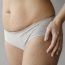 How Should You Deal With Stretch Marks in Teenagers